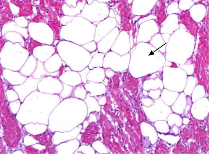 The transverse of pharyngotympanic cavity